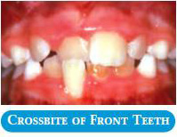 common-ortho-problem-1