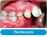 common-ortho-problem-3